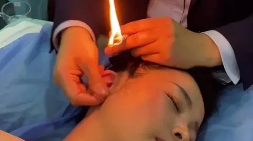 耳烛服务